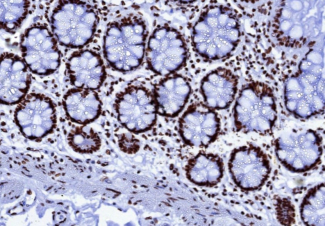 NUCLEOLIN (MARKER OF HUMAN CEL