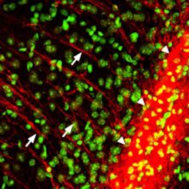 P2Y12 RECEPTOR ANTIBODY