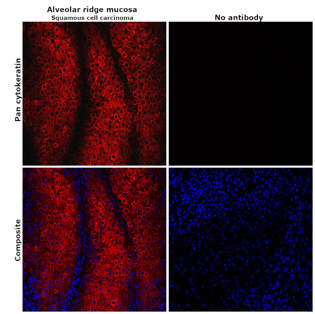ANTI-PAN CYTOKERATIN EF660 MAB