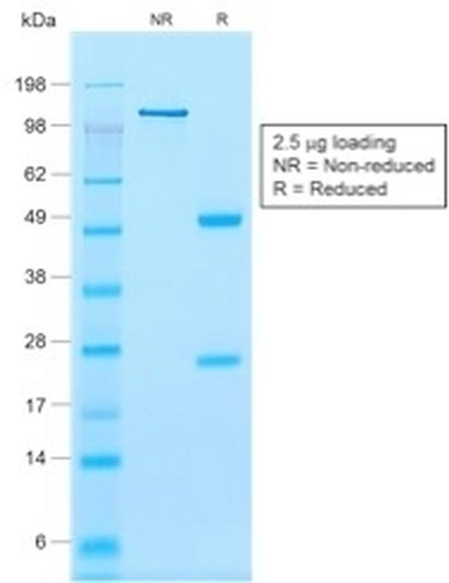 CALPONIN-1