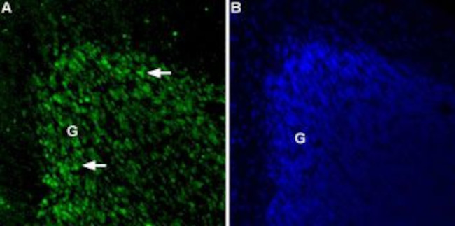 TPCN2 ANTIBODY