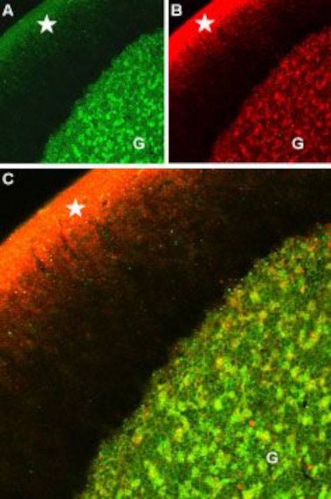 CAV1.2 (CACNA1C) ANTIBODY