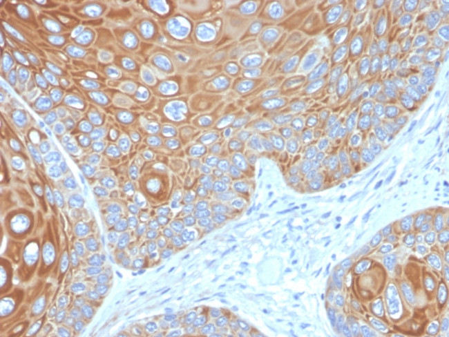 CYTOKERATIN 5 (KRT5)