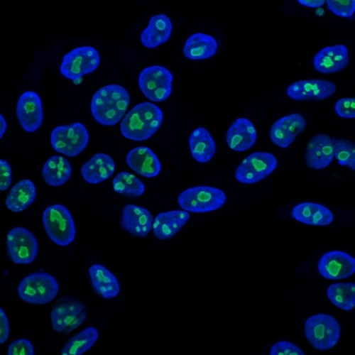 NUCLEOLIN