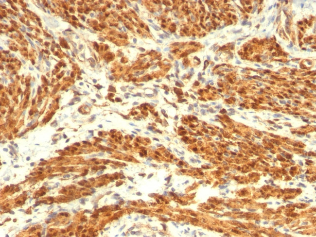 CALPONIN-1 (SMOOTH MUSCLE MARK