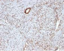 NUCLEOLIN (MARKER OF HUMAN CEL