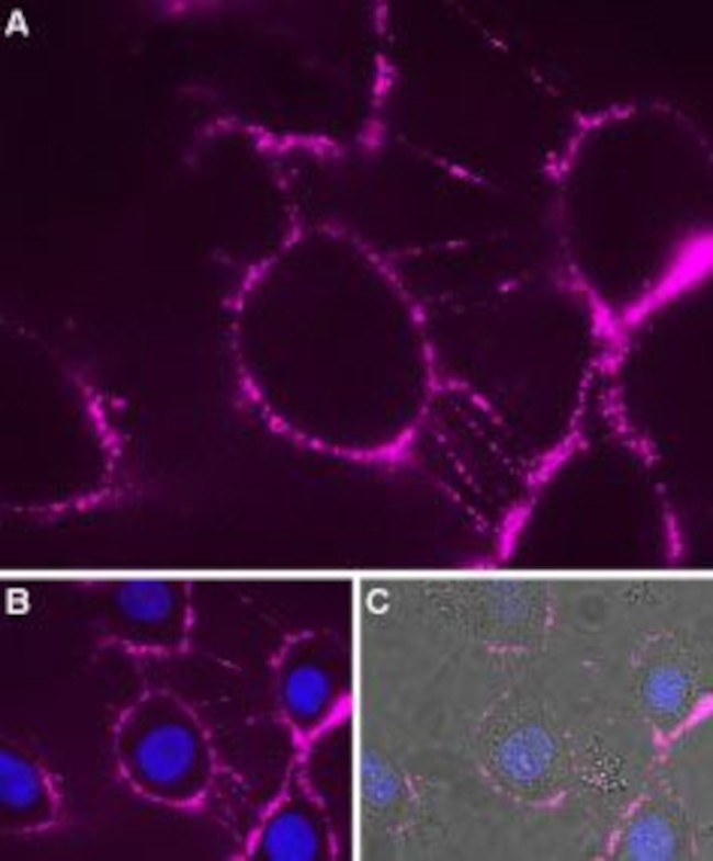 P2X7 RECEPTOR (EXTRACELLULAR)