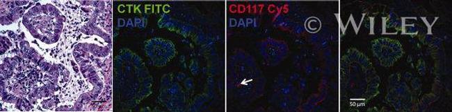 ANTI-PAN CYTOKERATIN EF570 MAB