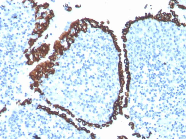 CYTOKERATIN 5 (KRT5)