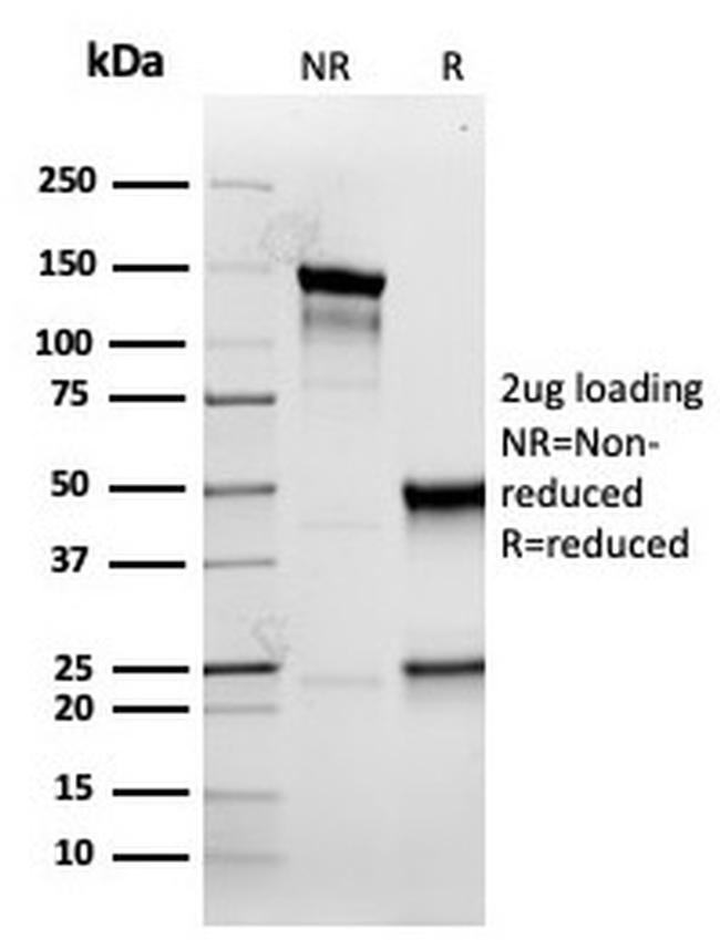 CYTOKERATIN 5 (KRT5)