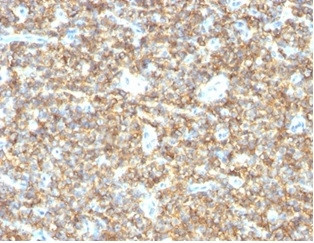 CD99/MIC2 (EWING‘S SARCOMA MAR
