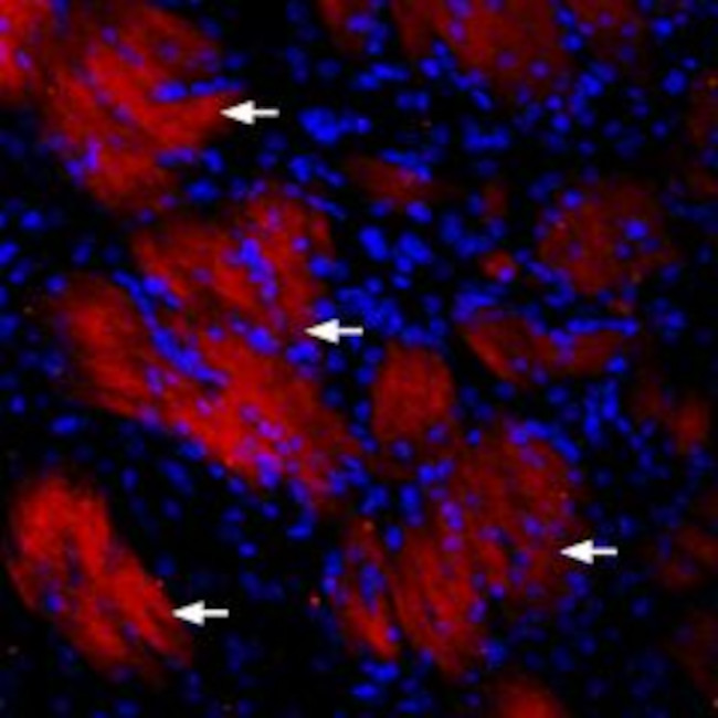 P2Y12 RECEPTOR ANTIBODY ATTO 5