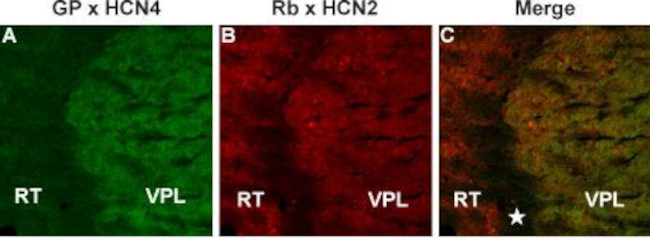 HCN2 ANTIBODY