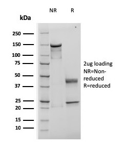 TIMP1 (COLORECTAL CANCER BIOMA