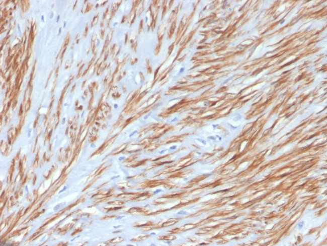 CALPONIN-1