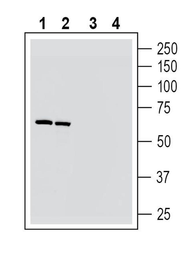 NICOTINIC ACETYLCHOLINE RECEPT