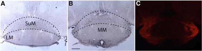 MCHERRY RAT MONOCLONALANTIBODY