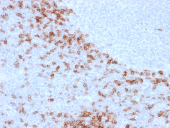 IGD (IMMUNOGLOBULIN DELTA HEAV