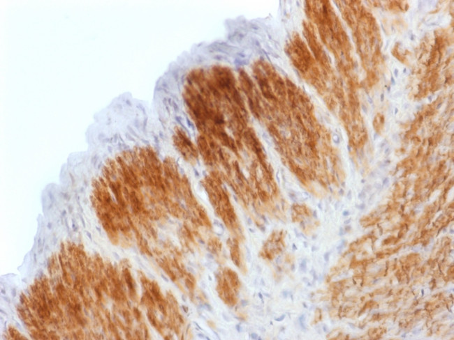 CALPONIN-1