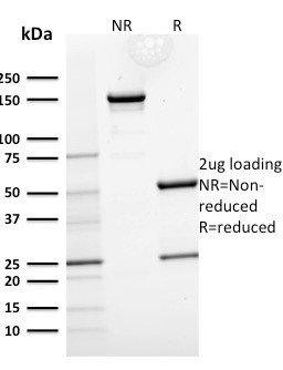 CYTOKERATIN 15 (ESOPHAGEAL SQU