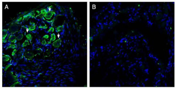 PIEZO2 ANTIBODY