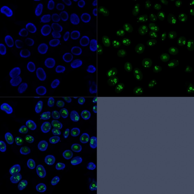 NUCLEOLIN (MARKER OF HUMAN CEL