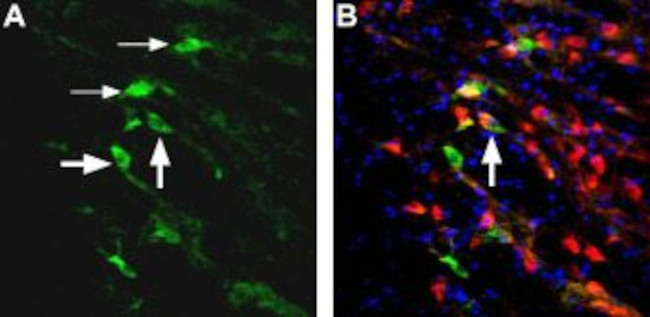 NMDAR2D (GRIN2D) (EXTRACELLULA