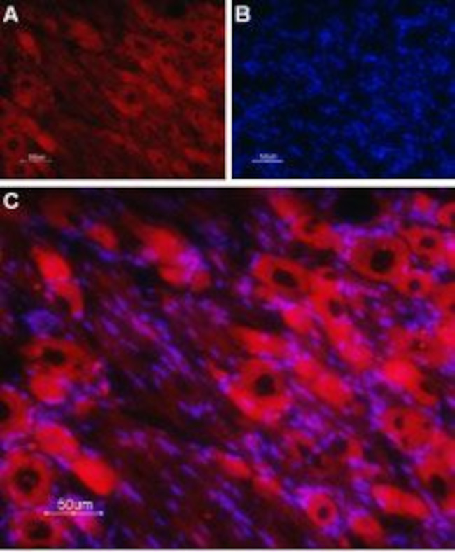 NICOTINIC ACETYLCHOLINE RECEPT