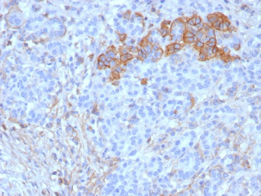 CD99/MIC2 (EWING‘S SARCOMA MAR