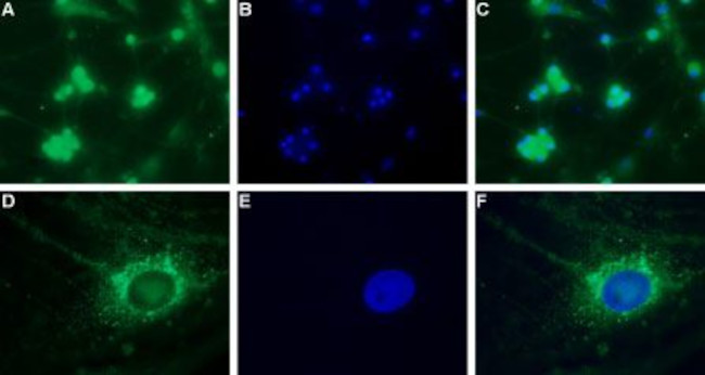 CAV3.2 (CACNA1H) ANTIBODY