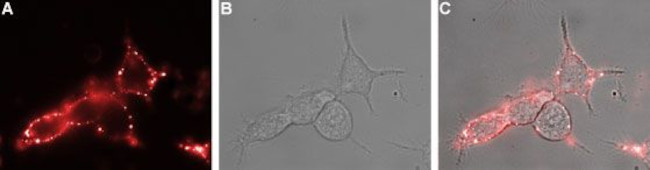 NICOTINIC ACETYLCHOLINE RECEPT