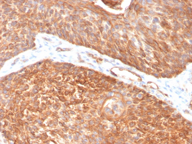 CYTOKERATIN 5 (KRT5)