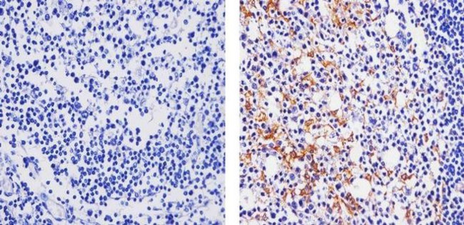 CCL3 ANTIBODY