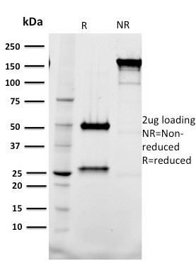 TAL1 ANTIBODY