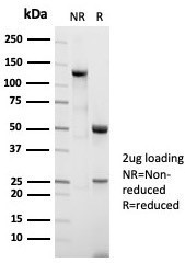 NUCLEOLIN (MARKER OF HUMAN CEL