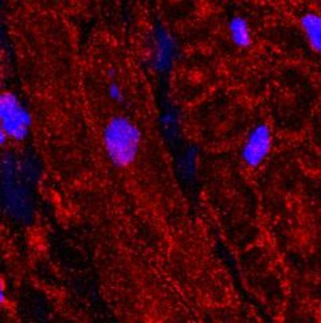 CAV1.2 (CACNA1C) ANTIBODY