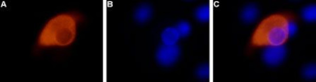 TRPV1 (VR1) ANTIBODY