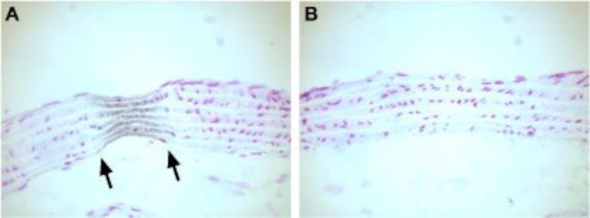 CAV1.2A (CACNA1C) ANTIBODY