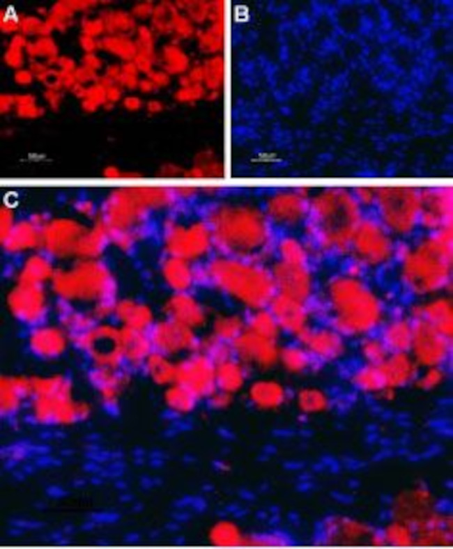 NICOTINIC ACETYLCHOLINE RECEPT