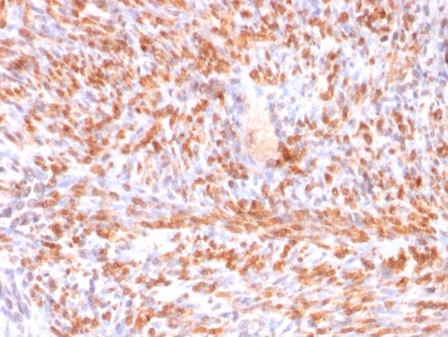CALPONIN-1