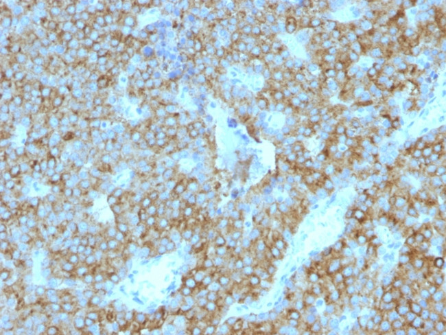 PARATHYROID HORMONE (PTH) (C-T