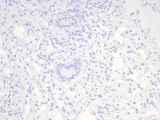 NUCLEOLIN (MARKER OF HUMAN CEL