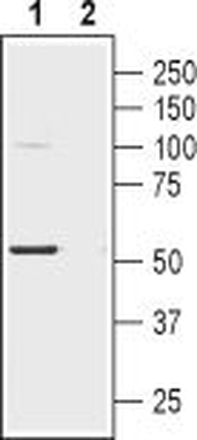 NICOTINIC ACETYLCHOLINE RECEPT