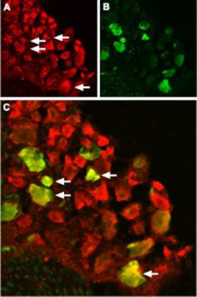 TRPV1 (VR1) ANTIBODY