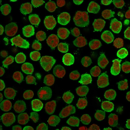 CALPONIN-1 (SMOOTH MUSCLE MARK