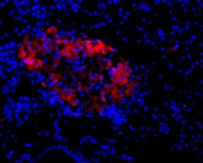 NMDAR2C (GRIN2C) (EXTRACELLULA