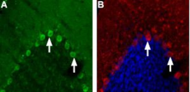 NICOTINIC ACETYLCHOLINE RECEPT