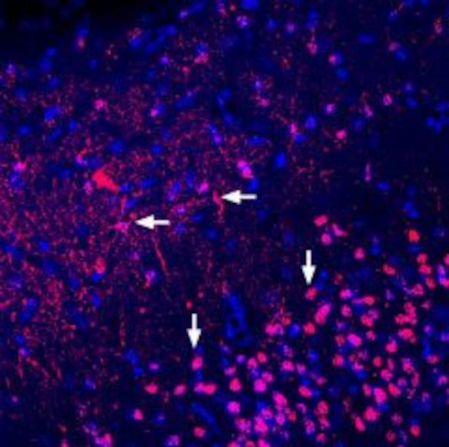 ADENOSINE A2A RECEPTOR (EXTRAC