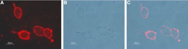 NICOTINIC ACETYLCHOLINE RECEPT