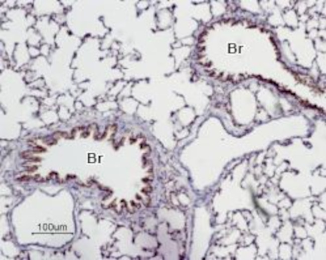 ADENOSINE A2A RECEPTOR ANTIBOD